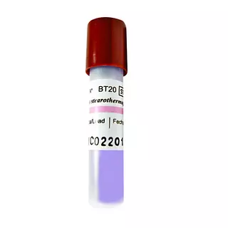 Indicador Biológico